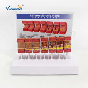 Modelo de <span class=keywords><strong>Arteriosclerosis</strong></span> con Tarjeta de Instrucciones, Modelo Anatómico de Lesiones Vasculares para <span class=keywords><strong>la</strong></span> Educación sobre <span class=keywords><strong>la</strong></span> Salud Cardiovascular - Product Image 3