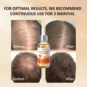 Suero Profesional de Arginina para Reparación de Raíces Capilares, Tónico Anticaída Efectivo por 3 Meses, Aceite para el Crecimiento del Cabello con Biotina y Jengibre, Logotipo Personalizado - Product Image 3