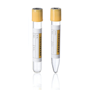 Tubo de vacío desechable para orina, tubo perforable de 10 ml y 16×100 mm para recolección de muestras de orina para laboratorio hospitalario - Product Image 3