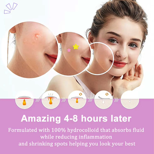 Produit phare direct usine, OEM personnalisé, marque privée, patch hydrocolloï<span class=keywords><strong>de</strong></span> en PU pour l'acné du visage, soin <span class=keywords><strong>de</strong></span> l'acné, cicatrisation améliorée - Product Image 6