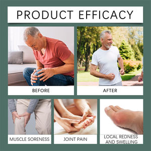 South Moon 50g <span class=keywords><strong>Gel</strong></span> de soin apaisant Douleurs musculaires Douleurs articulaires Rougeurs Gonflement <span class=keywords><strong>Gel</strong></span> soulageant - Product Image 5