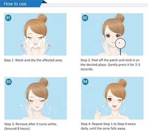72 pontos Hydrocolloid Pimple Patches focado acne tratamento de ação rápida solução de pele clara com Tea Tree Oil - Product Image 4