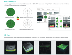 Optik SJ Okt Ophthalmological 2800 segmen depan dan posior optik Okt tomografi penghasil optik - Product Image 5