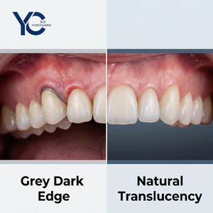 Couronnes temporaires en résine pour facettes dentaires, résine blanchissante, produits dentaires, couronnes en céramique, zircone - Product Image 3
