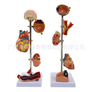 Modelo de hipertensión/presión arterial; Modelo de diabetes/visceras patológicas; Presión arterial patológica; Cerebro; Ojo; Corazón; Riñón; - Product Image 3