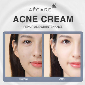 Meilleure crème pour le visage sans paraben <span class=keywords><strong>Anti</strong></span>-acné et réparateur et Centella & Ceramide Crème hydratante pour le visage avec mon logo - Product Image 5