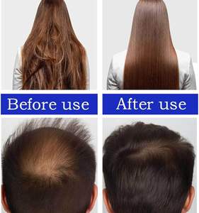 สเปรย์บำรุงเส้นผ<span class=keywords><strong>ม</strong></span>และหนังศีรษะสูตรวีแกนแท้ 30 <span class=keywords><strong>ม</strong></span>ล. สำหรับแบรนด์ส่วนตัว ป้องกันผ<span class=keywords><strong>ม</strong></span>ร่วง ผส<span class=keywords><strong>ม</strong></span>บาตานาและโรสแมรี่ - Product Image 6