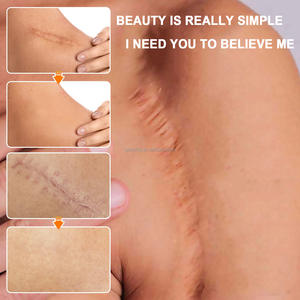 ครีมลบรอยแผล<span class=keywords><strong>เป็น</strong></span>จากสิว รอยแตกลาย ครีมลดรอยแผล<span class=keywords><strong>เป็น</strong></span>หลังผ่าตัด ครีมกระชับสัดส่วน - Product Image 5