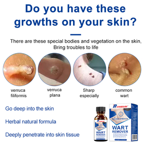 REINREUDEウォートリムーバー液体-一般的でフラットなウォート処理のためのベストセラー - Product Image 3