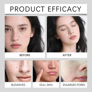 Limpiador Facial Espumoso de Arroz Negro Personalizado 100g, Limpieza Profunda, Iluminador, Hidratante, Apto para Todo Tipo de Piel, Uso Diario - Product Image 2