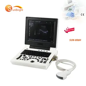 sunbright promotion price made in China factory cheap Obstetrics Gynecology ultrasound machine