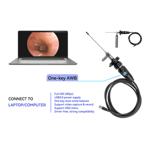 Caméra endoscopique portable USB 3.0 Full HD, équipement d'imagerie médicale pour l'inspection et la chirurgie vétérinaire - Product Image 6