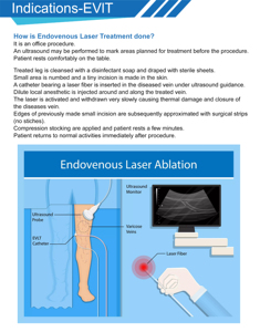 Laser Diode EVLT EVLA 980nm 1470nm 50W 3000ms, liệu pháp cắt bỏ tĩnh mạch bằng laser qua tĩnh mạch cho chứng giãn tĩnh mạch ở chân - Product Image 5