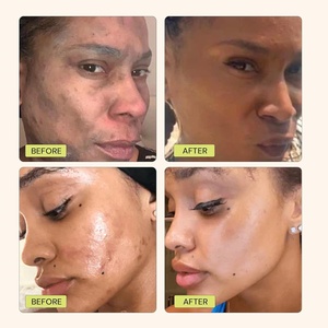 มาส์กหน้าดินเหนียววิตามินซีช่วยให้ผิวขาวขึ้นลดรอยดำรอยแผลเป็นจากสิวบรรเทาผิวกระชับรูขุมขนหน้ากากดิน - Product Image 4