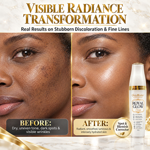 เซรั่มบำรุงผิว OEM Royal Glow ช่วย<span class=keywords><strong>ให้</strong></span>ผิวกระจ่างใส <span class=keywords><strong>ลด</strong></span>เลือนจุดด่างดำและรอยดำ <span class=keywords><strong>ลด</strong></span>เลือนริ้วรอย เพิ่มความชุ่มชื้นและเสริมสร้างเกราะป้องกันผิว - Product Image 5