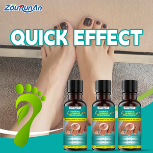 Gran oferta de líquido para tratamiento de hongos en las uñas, solución eficaz para la infección fúngica de las uñas de los pies, fórmula de hierbas naturales - Product Image 2