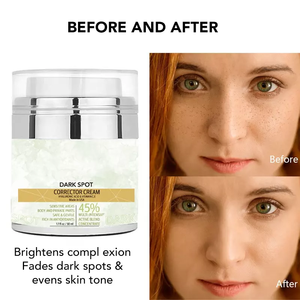 Meilleure Crème de <span class=keywords><strong>Teint</strong></span> Éclaircissante et Raffermissante Quotidienne pour le Visage et le Corps, Soin Anti-Acné, Crème Visage Blanchissante Sans Huile - Product Image 5