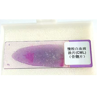 Fixed set Blood Test for medical microscope slide blood smear prepared microscope slides
