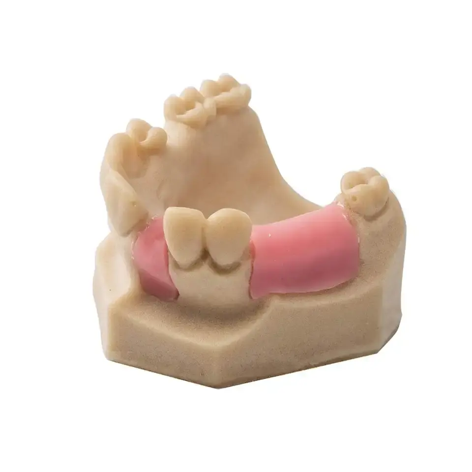 Prix de gros Easyinsmile modèle de dents éducatives modèle de dents de mâchoire manquante pour usage dentaire