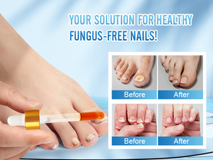 2025 Venta caliente OEM ODM onicomicosis eliminar <span class=keywords><strong>hongos</strong></span> y mejorar las uñas <span class=keywords><strong>de</strong></span> los <span class=keywords><strong>pies</strong></span> y las uñas líquido cuidado <span class=keywords><strong>de</strong></span> las uñas <span class=keywords><strong>de</strong></span> los <span class=keywords><strong>pies</strong></span> - Product Image 3