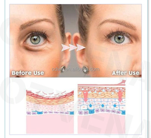 OTVENA Crème réparatrice <span class=keywords><strong>anti</strong></span>-cernes instantanée 2 minutes effet visible - Product Image 2