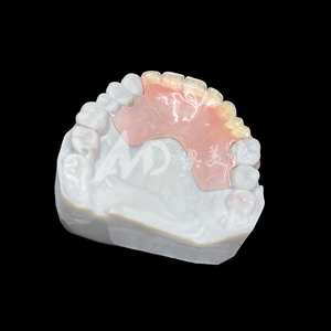 Service d'externalisation de prothèses dentaires flexibles personnalisées, prothèses amovibles Valplast pour laboratoire <span class=keywords><strong>dentaire</strong></span>, acceptation des fichiers STL - Product Image 4