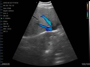 Konted MDR Gen5 lòng bàn tay siêu âm xách tay không dây máy siêu âm 3 trong <span class=keywords><strong>1</strong></span> đa chức năng duy nhất <span class=keywords><strong>probe</strong></span> cho toàn bộ cơ thể - Product Image 5