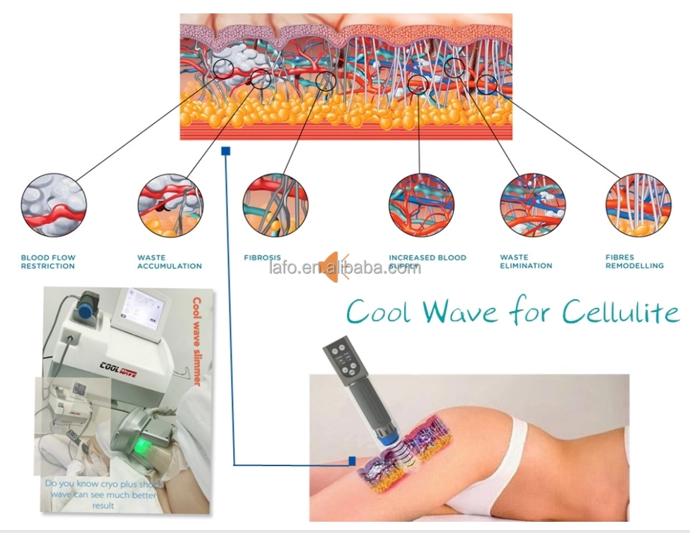 2 in 1 body slimming weight loss portable cryolipolisis shock wave cryolipolysis shockwave machine