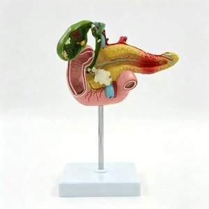 DARHMMY Modello Anatomico del Pancreas Patologico in PVC a Grandezza Naturale per Formazione Medica, Ospedaliera ed Educativa - Product Image 1