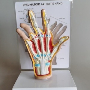 Simulateur de pathologie de la main de démonstrateur clinique de main pour l'enseignement orthopédique et rhumatologique - Product Image 4