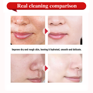 มูสล้างหน้าควบคุมความมัน <span class=keywords><strong>โฟม</strong></span>ทำความสะอาดล้ำลึกเพื่อผิวสดชื่น ลดความมันส่วนเกินและเติมความชุ่มชื้น ไม่ทำให้ผิวแห้งตึง - Product Image 5