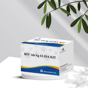 Kit ELISA AntihIV a Precio de Fábrica, Prueba Rápida de Sangre para Uso Clínico, Se Acepta OEM - Product Image 5