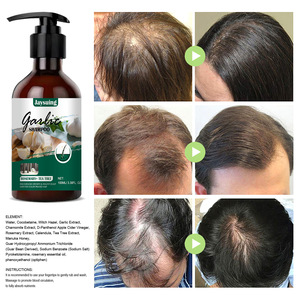 Champú Orgánico de Ajo B109 para Limpieza Profunda y Anticaspa con Fórmula Concentrada para el Crecimiento del Cabello y Anticaída (100 ml Líquido) - Product Image 4