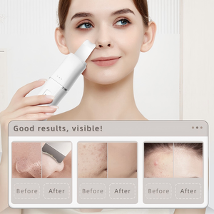 5 in 1 Multifunctional <b>Electric</b> Facial Care Kit Cleansing <b>Massager</b> Replaceable <b>Head</b> Charging Base for Home Beauty Routine - Product Image 4