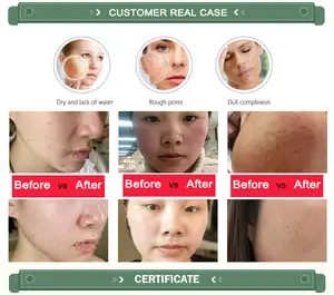 Masque facial médical en feuille Masque facial personnalisé Peau anti-acné sensible Masque facial triple collagène pour femme