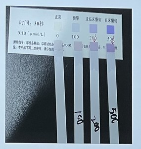 우유 샘플을 검출하는 젖소를위한 테스트 키트 케톤증 미터 수의학 - Product Image 5