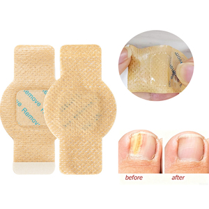 Parches para el <span class=keywords><strong>Tratamiento</strong></span> de <span class=keywords><strong>Hongos</strong></span> <span class=keywords><strong>en</strong></span> Uñas de los Pies y de las Manos, para Uñas Gruesas y Decoloradas - Product Image 4