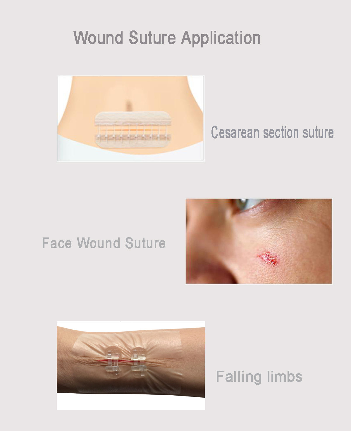 Thin Type Hydrocolloid Wound Dressing