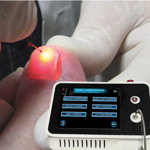 Gran oferta, eliminación de hongos en uñas con láser de 980nm, onicomicosis, láser personalizado, elimina las infecciones fúngicas para uñas hermosas y saludables - Product Image 1