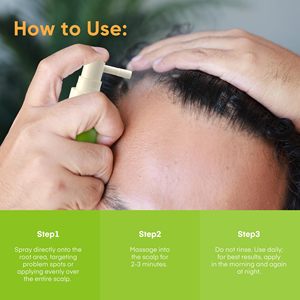Siero Spray per la Crescita dei <span class=keywords><strong>Capelli</strong></span> con Rosmarino e Biotina, Etichetta Privata, Biologico ed Erboristico, Favorisce la Crescita Sana e Protegge dalla <span class=keywords><strong>Caduta</strong></span> dei <span class=keywords><strong>Capelli</strong></span> - Product Image 6