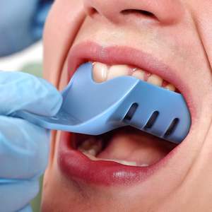 ถาดพิมพ์ฟันแบบมีรูพรุน10ชิ้นชุดถาดพิมพ์แบบ Autoclavable ที่ยึดฟันพลาสติกสำหรับคลินิกทันตกรรม - Product Image 4