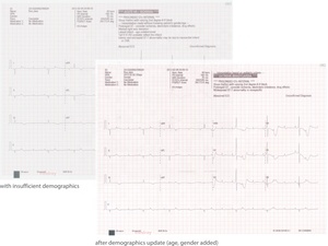 Appareil ECG vétérinaire portable Mindray à prix avantageux en Chine, Mindray BeneHeart R12 ECG pour animaux de grande et petite taille - Product Image 5
