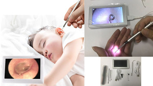 4,5 Pantalla Lcd Consumidor Ent Endoscopio Auto Comprobación Video Cámara de otoscopio <span class=keywords><strong>digital</strong></span> - Product Image 3