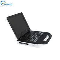 Système d'échographie Doppler couleur portable EO-Med CU30 avec écran LCD de 15 pouces, 2 connecteurs de sondes, batterie de 4,5 heures