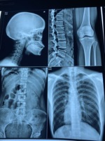 Impresora de Película Térmica para Rayos X para Película de Rayos X Médica y No Médica Fuji