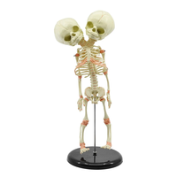Modèle de squelette anatomique pour nourrisson à double tête XX-A113 de 30 cm, outil d'éducation scientifique médicale pour les hôpitaux et les écoles