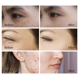 Suero Facial con Vitamina C, Ácido Hialurónico, Retinol y Niacinamida, Personalizado con Logotipo de Fábrica OEM - Product Image 6