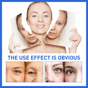 Suero Facial Antienvejecimiento con <span class=keywords><strong>C</strong></span>úrcuma, Botok, Pro-Xylane y Péptidos, Blanqueador y Antiarrugas, <span class=keywords><strong>en</strong></span> Oferta - Product Image 5