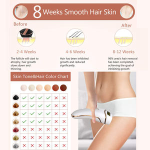 Épilateur IPL professionnel PAKISS avec 5 niveaux d'énergie réglables pour usage domestique - Product Image 2