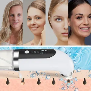 Éliminateur de points noirs du visage, électrique, nettoyeur d'acné, outil de nettoyage des pores, 1 pièce - Product Image 5